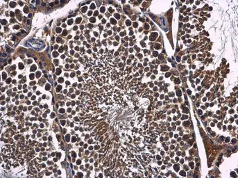 Anti-FBXL17 antibody [C1C3] used in IHC (Paraffin sections) (IHC-P). GTX119211