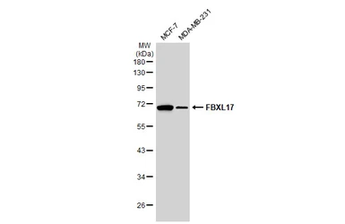 Anti-FBXL17 antibody [C1C3] used in Western Blot (WB). GTX119211
