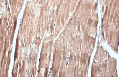 Anti-FBXL17 antibody [C1C3] used in IHC (Paraffin sections) (IHC-P). GTX119211