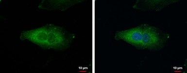 Anti-C20orf7 antibody [N3C3] used in Immunocytochemistry/ Immunofluorescence (ICC/IF). GTX119214