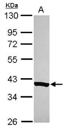 Anti-C20orf7 antibody [N3C3] used in Western Blot (WB). GTX119214