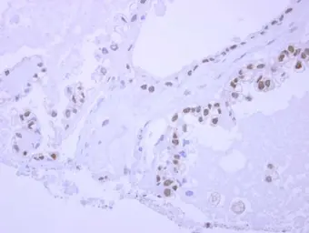 Anti-NPEPL1 antibody [N2C1], Internal used in IHC (Paraffin sections) (IHC-P). GTX119217