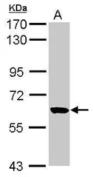 Anti-RUFY1 antibody [N2C2], Internal used in Western Blot (WB). GTX119222