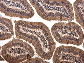 Anti-SPRY4 antibody used in IHC (Paraffin sections) (IHC-P). GTX119230