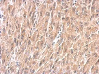 Anti-SPRY4 antibody used in IHC (Paraffin sections) (IHC-P). GTX119230