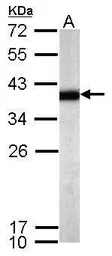 Anti-SPRY4 antibody used in Western Blot (WB). GTX119230