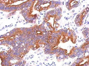 Anti-ITFG3 antibody [N1C1] used in IHC (Paraffin sections) (IHC-P). GTX119235