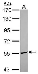 Anti-ITFG3 antibody [N1C1] used in Western Blot (WB). GTX119235