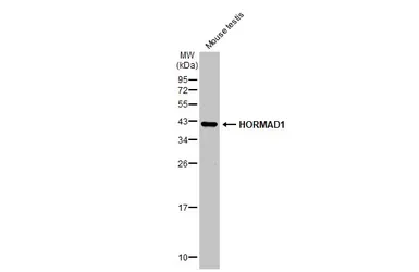 Anti-HORMAD1 antibody [N2C2], Internal used in Western Blot (WB). GTX119236