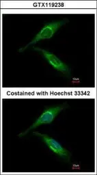 Anti-ARFGAP2 antibody used in Immunocytochemistry/ Immunofluorescence (ICC/IF). GTX119238