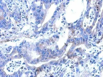 Anti-ARFGAP2 antibody used in IHC (Paraffin sections) (IHC-P). GTX119238