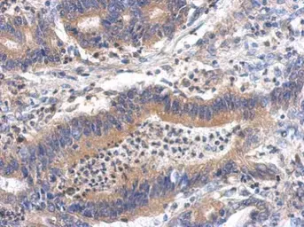 Anti-GHDC antibody [N1C2] used in IHC (Paraffin sections) (IHC-P). GTX119239