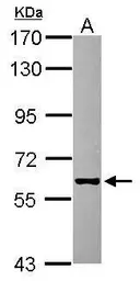 Anti-GHDC antibody [N1C2] used in Western Blot (WB). GTX119239