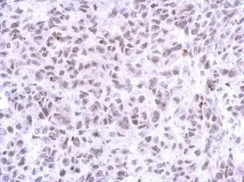 Anti-ZNF587 antibody used in IHC (Paraffin sections) (IHC-P). GTX119240
