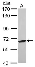 Anti-ZNF587 antibody used in Western Blot (WB). GTX119240