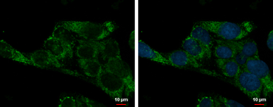 Anti-ADHFE1 antibody [N1C1] used in Immunocytochemistry/ Immunofluorescence (ICC/IF). GTX119264