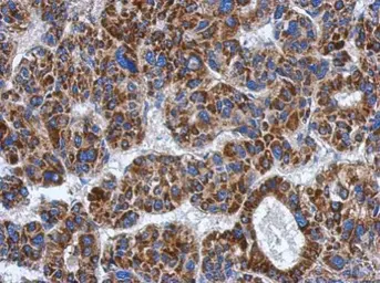 Anti-ADHFE1 antibody [N1C1] used in IHC (Paraffin sections) (IHC-P). GTX119264