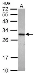Anti-ADHFE1 antibody [N1C1] used in Western Blot (WB). GTX119264