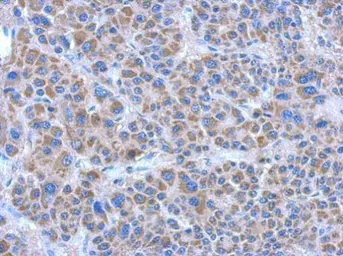 Anti-ADHFE1 antibody [N2C2], Internal used in IHC (Paraffin sections) (IHC-P). GTX119265