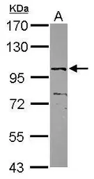 Anti-ZNF690 antibody [C1C3] used in Western Blot (WB). GTX119267
