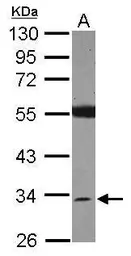 Anti-SDR16C5 antibody [N1C3] used in Western Blot (WB). GTX119280