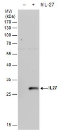 Anti-IL27 antibody [N1C3-2] used in Western Blot (WB). GTX119293