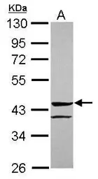 Anti-ANGPTL5 antibody [N2C3] used in Western Blot (WB). GTX119294
