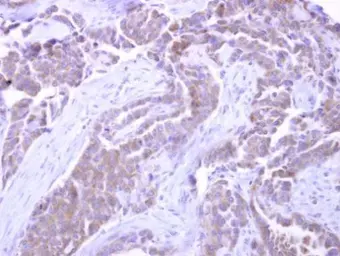 Anti-SNX33 antibody used in IHC (Paraffin sections) (IHC-P). GTX119295