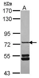 Anti-SNX33 antibody used in Western Blot (WB). GTX119295
