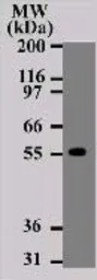 Anti-DR4 antibody [32A1380] used in Western Blot (WB). GTX11931