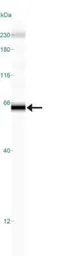 Anti-DR4 antibody [32A1380] used in Western Blot (WB). GTX11931