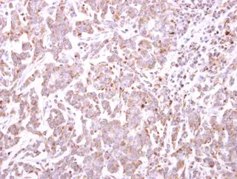Anti-TRIM49 antibody [N1C1] used in IHC (Paraffin sections) (IHC-P). GTX119323