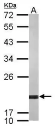 Anti-ARF5 antibody used in Western Blot (WB). GTX119329