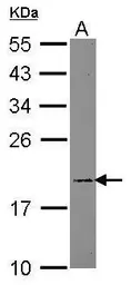 Anti-ARF5 antibody used in Western Blot (WB). GTX119329