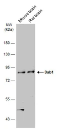 Anti-Dab1 antibody [N1N3] used in Western Blot (WB). GTX119336