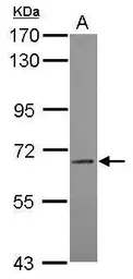 Anti-LILRB3 antibody [N1C1] used in Western Blot (WB). GTX119342