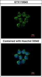 Anti-Kallistatin antibody [N2C2], Internal used in Immunocytochemistry/ Immunofluorescence (ICC/IF). GTX119343