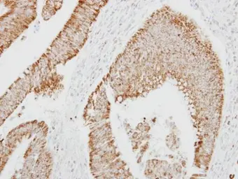 Anti-Kallistatin antibody [N2C2], Internal used in IHC (Paraffin sections) (IHC-P). GTX119343