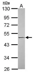 Anti-Kallistatin antibody [N2C2], Internal used in Western Blot (WB). GTX119343