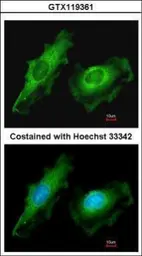 Anti-ITM2B antibody used in Immunocytochemistry/ Immunofluorescence (ICC/IF). GTX119361