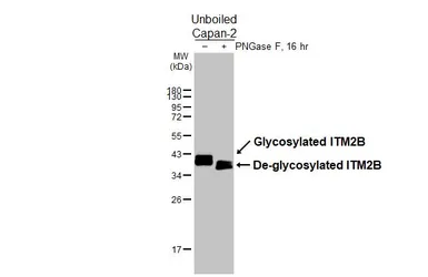 Anti-ITM2B antibody used in Western Blot (WB). GTX119361