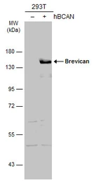 Anti-Brevican antibody [N1N2], N-term used in Western Blot (WB). GTX119374