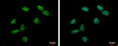 Anti-ZNF76 antibody used in Immunocytochemistry/ Immunofluorescence (ICC/IF). GTX119376