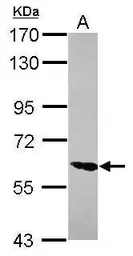 Anti-ZNF76 antibody used in Western Blot (WB). GTX119376
