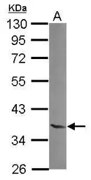 Anti-NTAN1 antibody [N1C3] used in Western Blot (WB). GTX119378
