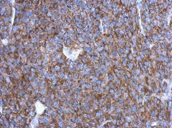 Anti-OVCA2 antibody [N1C3] used in IHC (Paraffin sections) (IHC-P). GTX119385