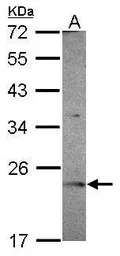 Anti-OVCA2 antibody [N1C3] used in Western Blot (WB). GTX119385