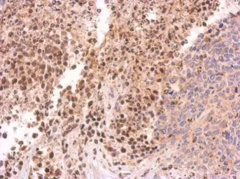 Anti-PIWIL4 antibody [C2C3], C-term used in IHC (Paraffin sections) (IHC-P). GTX119387