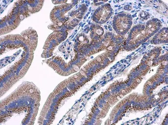 Anti-AAMP antibody used in IHC (Paraffin sections) (IHC-P). GTX119410