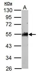 Anti-AAMP antibody used in Western Blot (WB). GTX119410